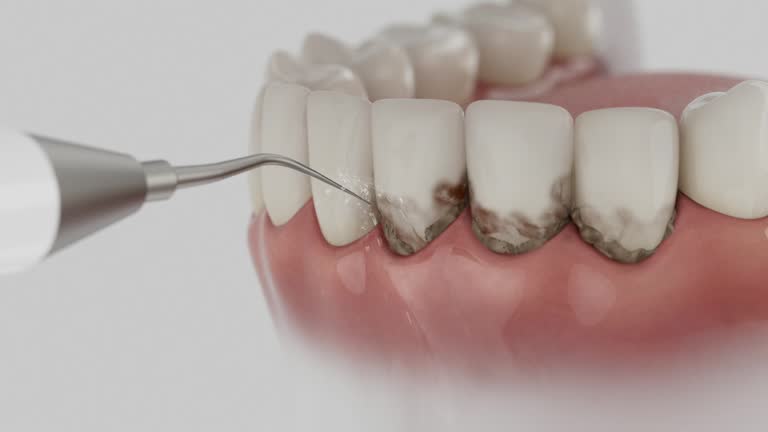 Trusted Dental Crowns And Bridges service in Burnt Store Marina, FL - Dentist Open Now